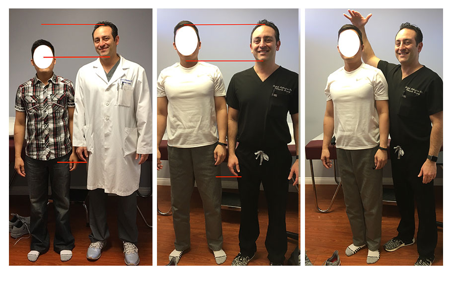 Height Lengthening procedure